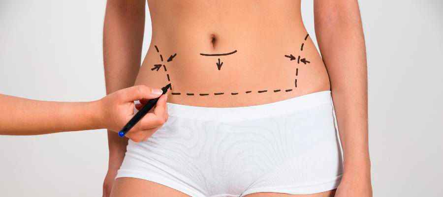 Image Title My Image