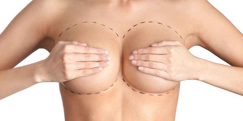 Image Title My Image